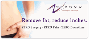 Zerona Review