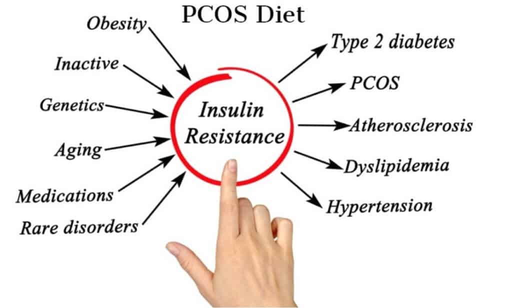 Image result for PCOS