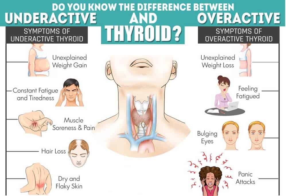 In thyroid how to weight loss