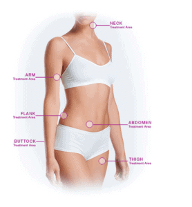 VelaShape Review