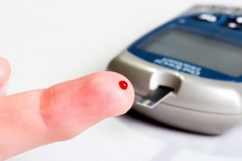 Low Blood Sugar And Weight Loss Surgery Low Blood Sugar And Weight Loss Surgery