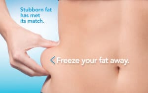 Freeze Fat Review